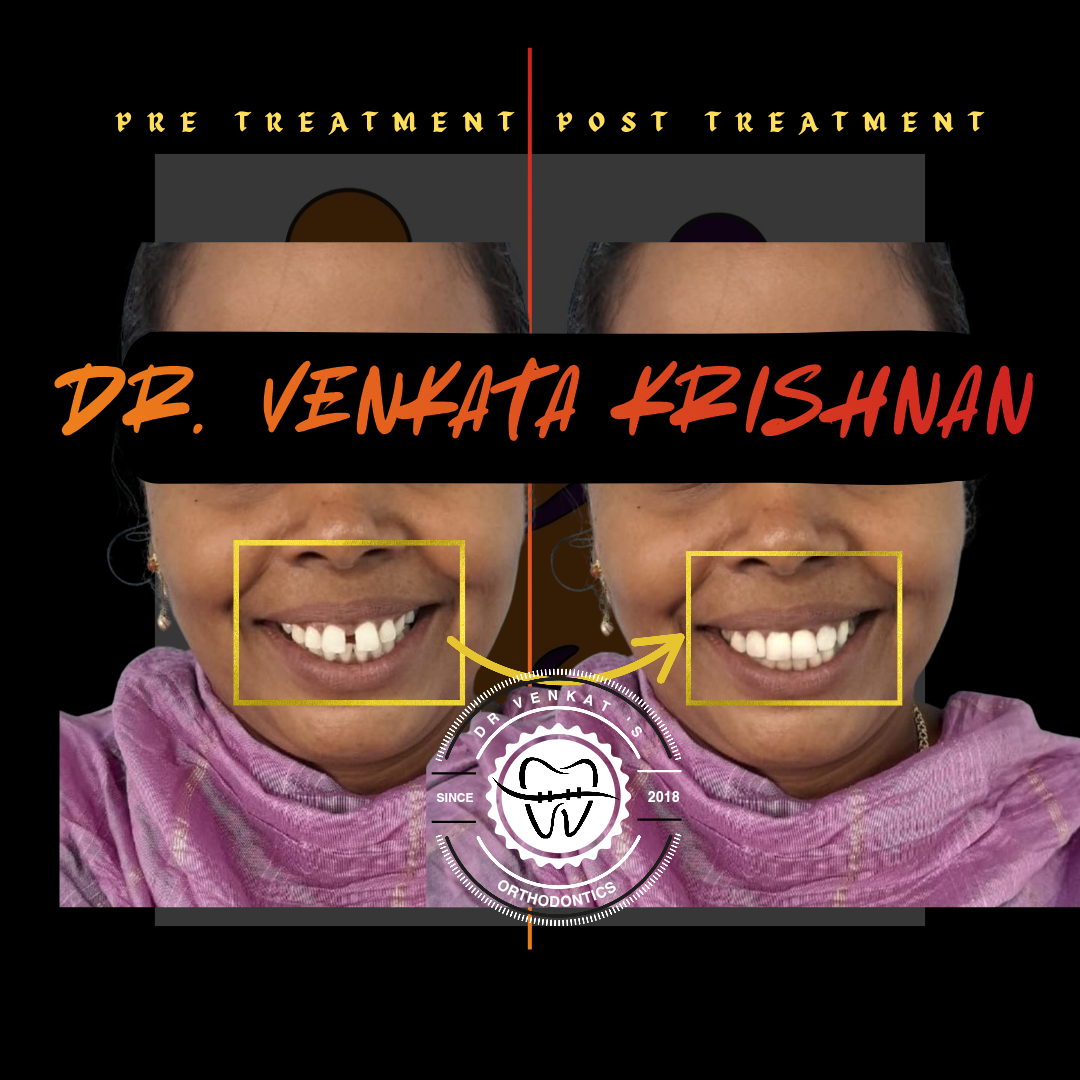 RV Dentalign clinic photo
