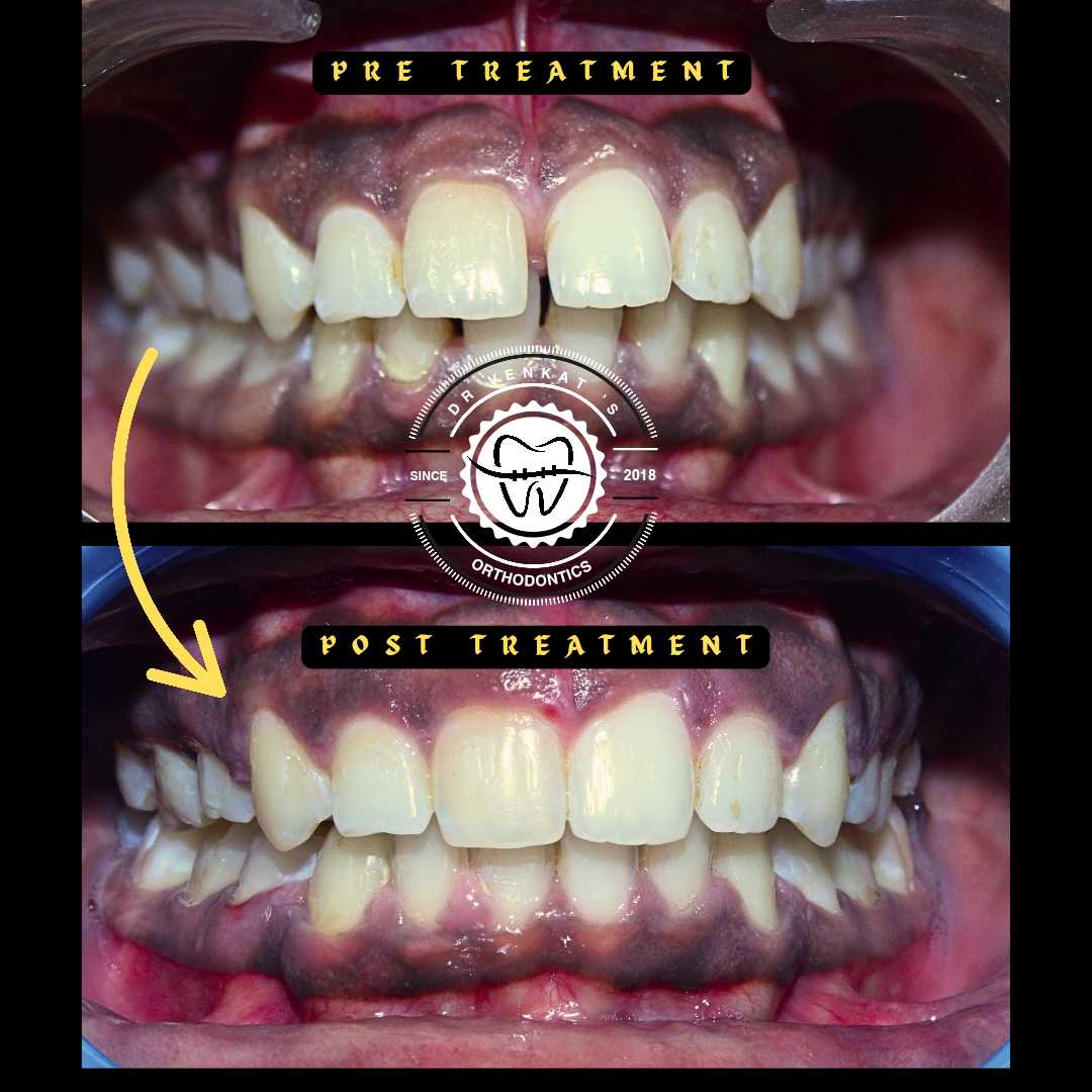 RV Dentalign clinic photo