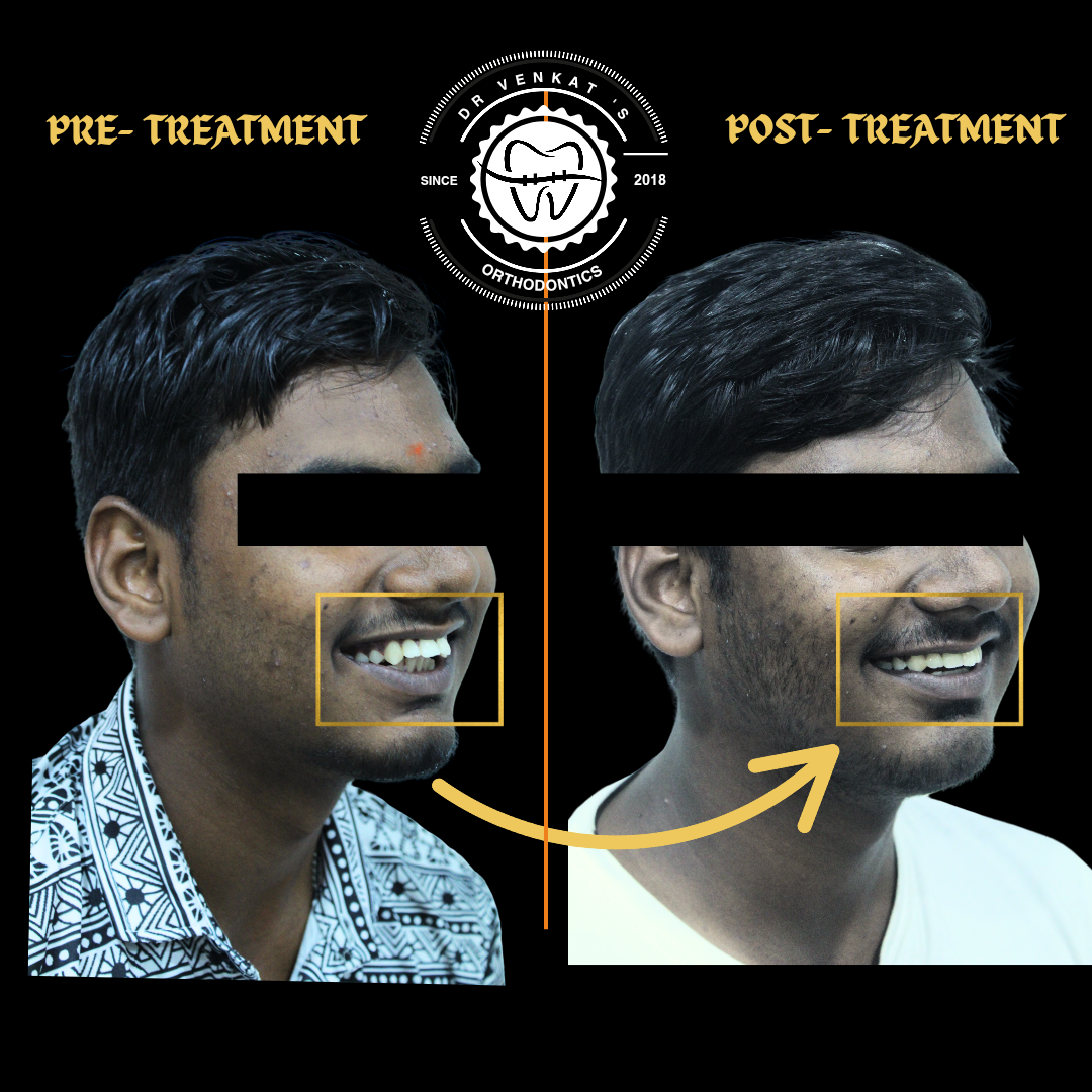 RV Dentalign clinic photo