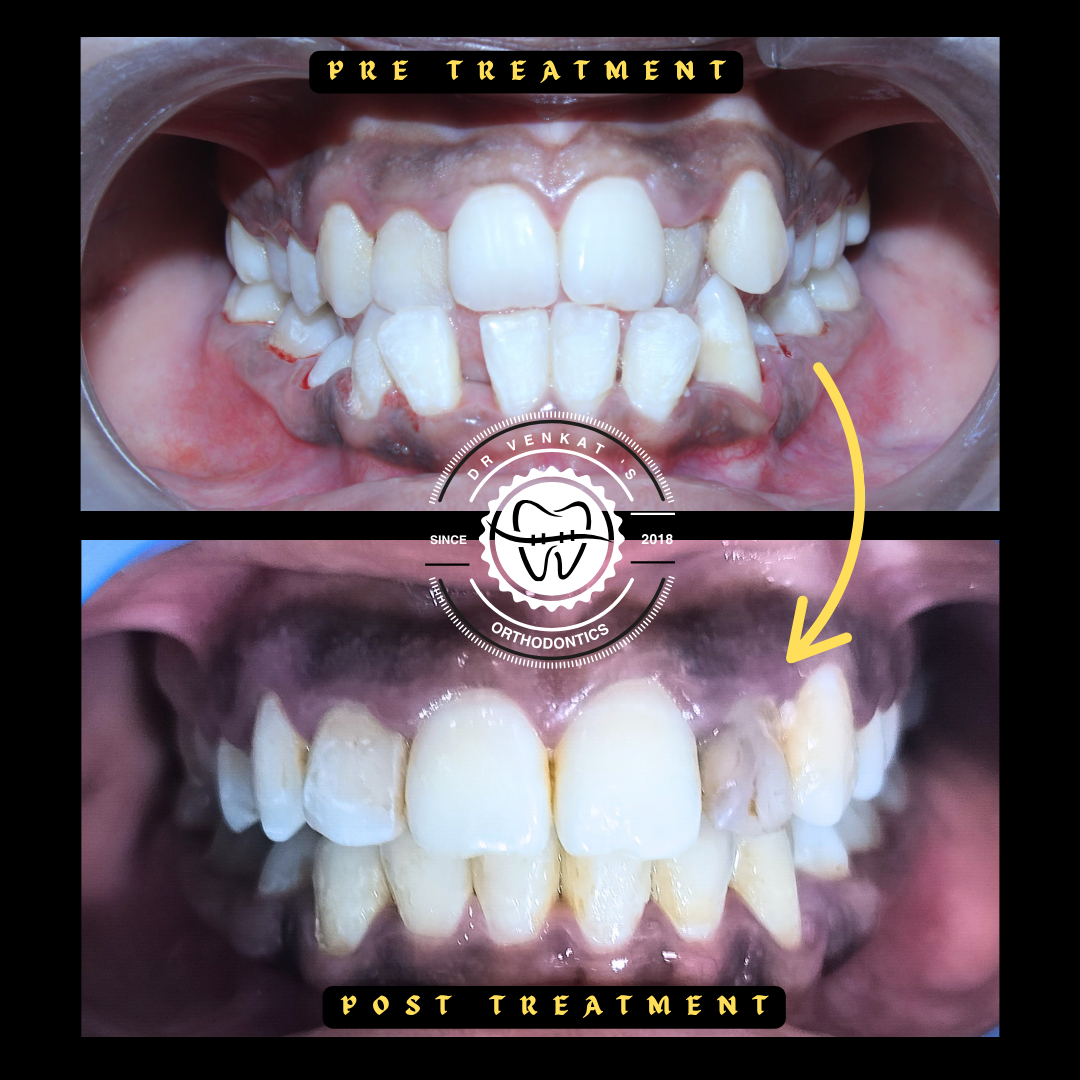 RV Dentalign clinic photo