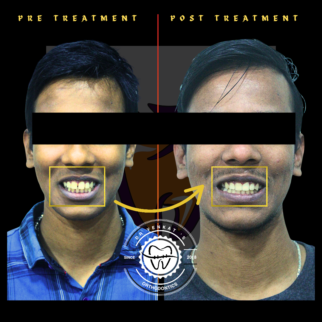 RV Dentalign clinic photo