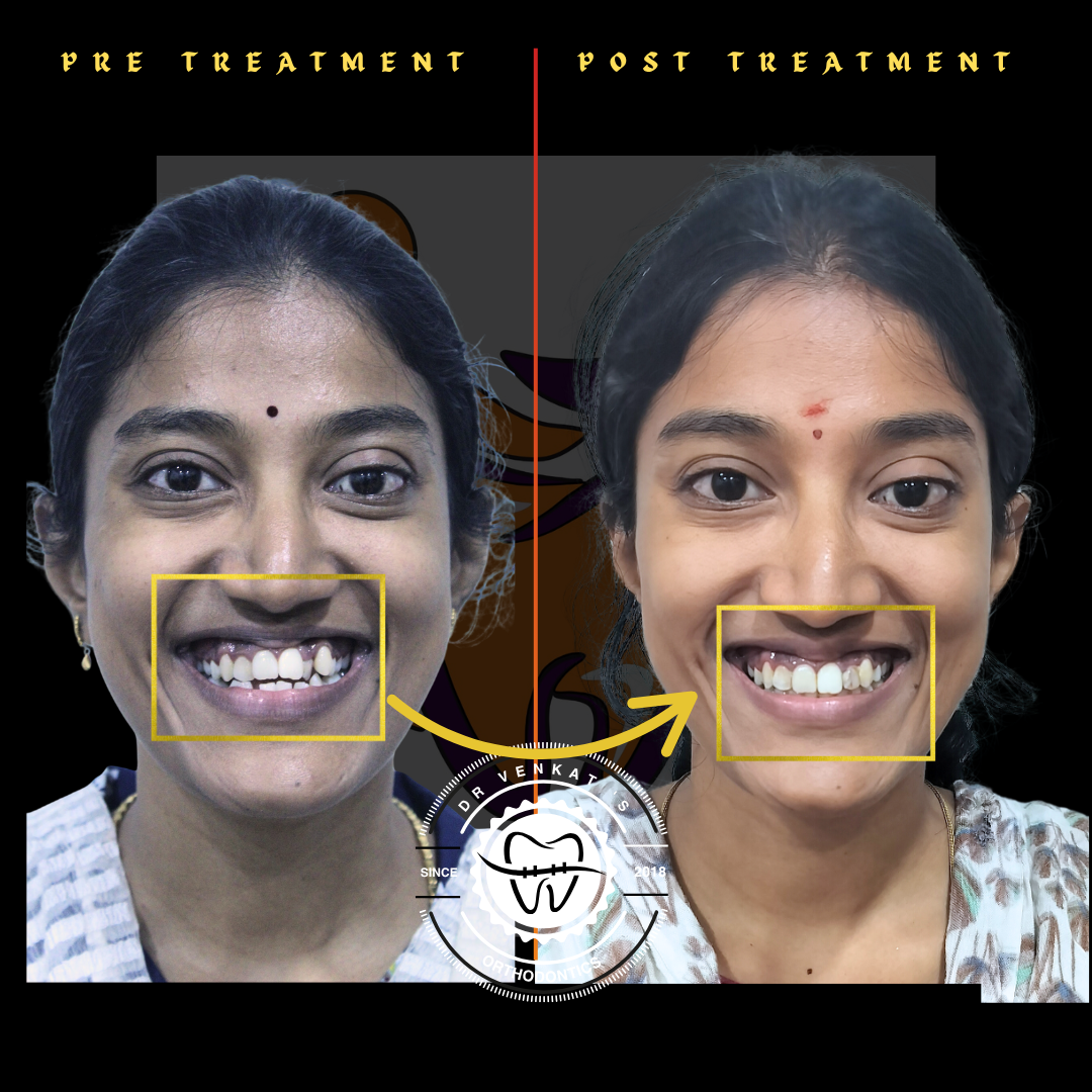 RV Dentalign clinic photo