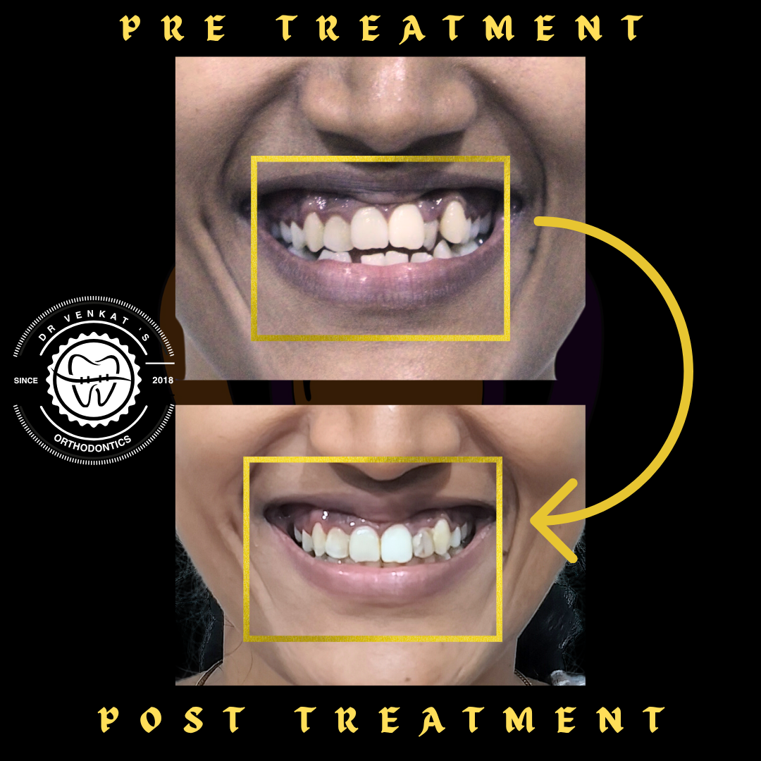 RV Dentalign clinic photo